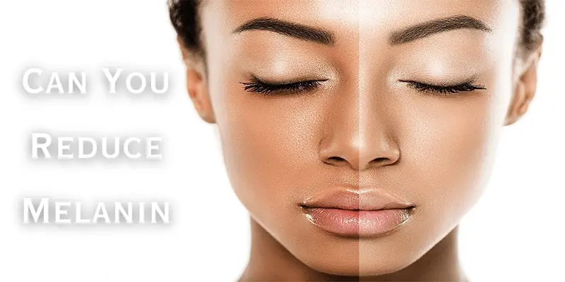 Can You Reduce Melanin in the Skin?