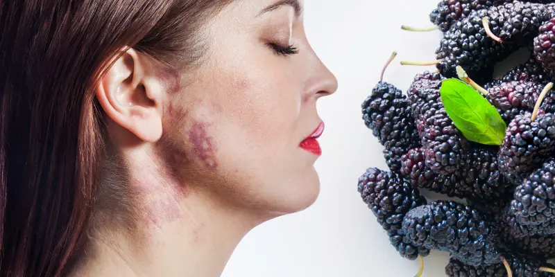 Possible Side Effects of Mulberry on Skin