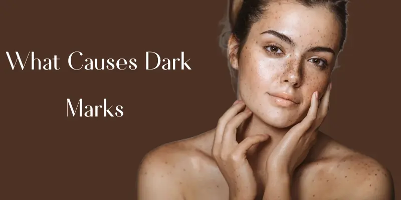 What Causes Dark Marks on the Upper Lip?
